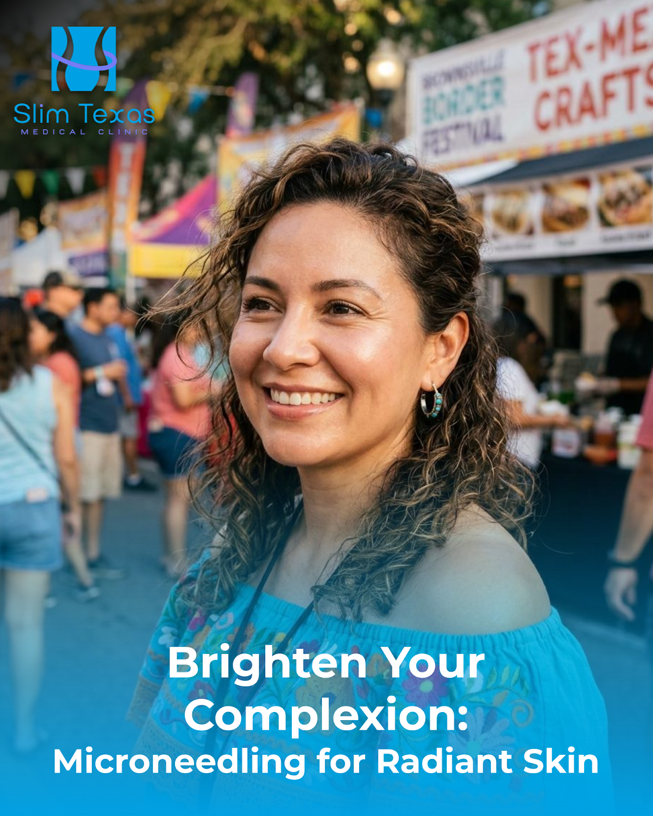 Brighten Your Complexion: Microneedling for Radiant Skin