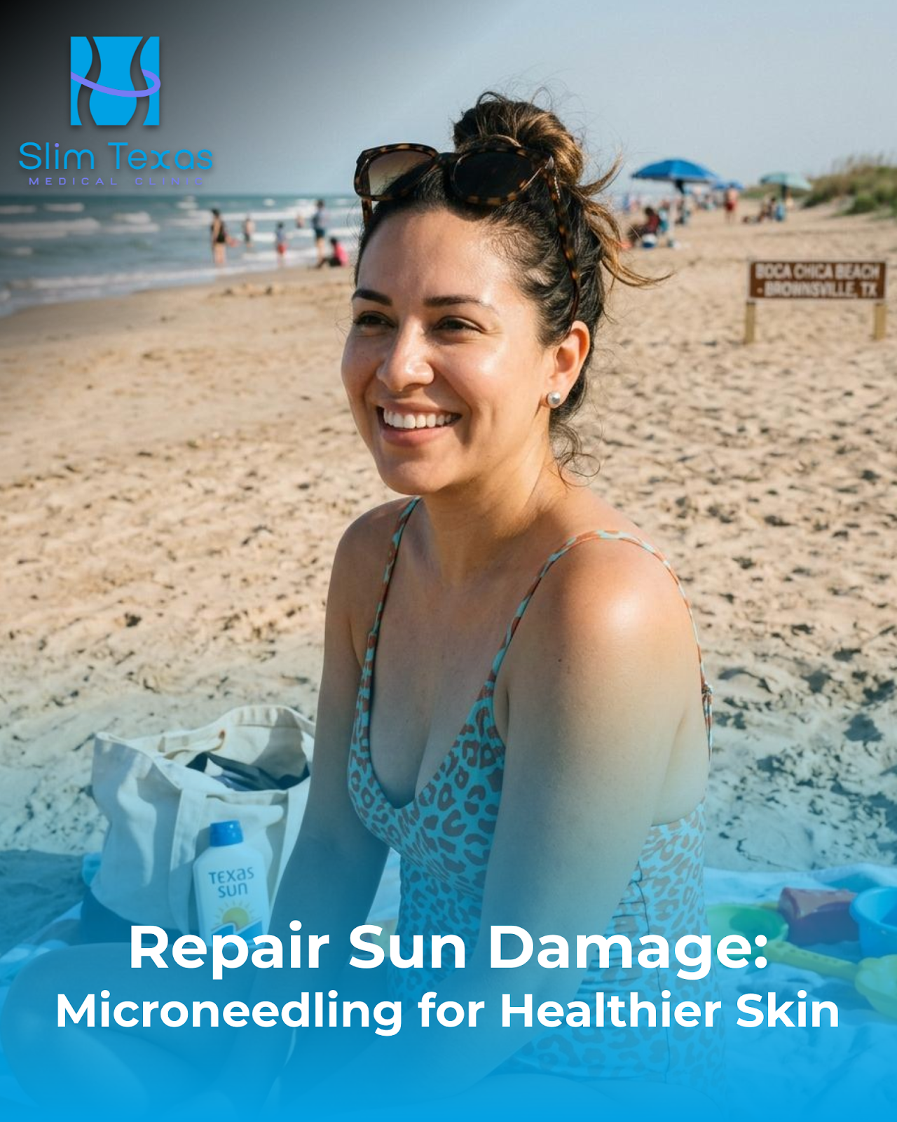 Repair Sun Damage: Microneedling for Healthier Skin