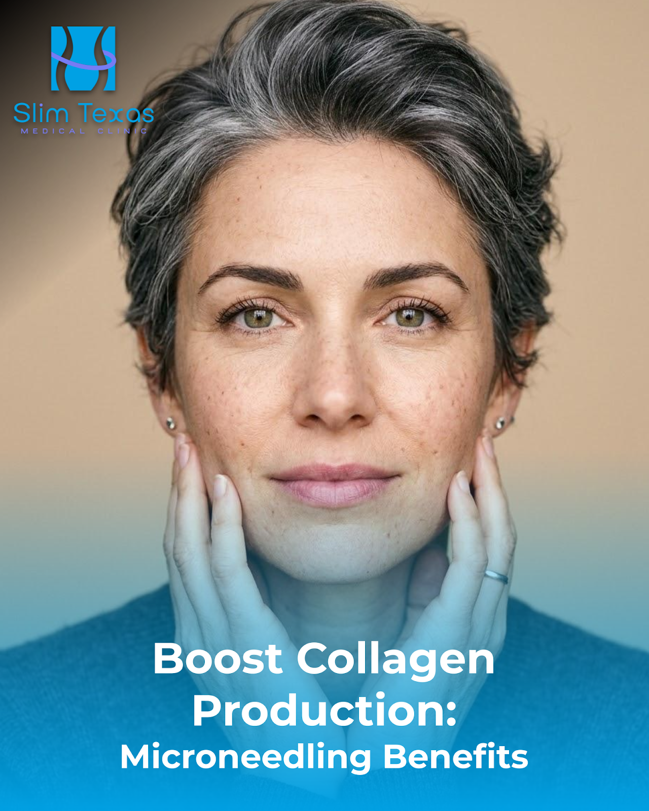 Boost Collagen Production: Microneedling Benefits