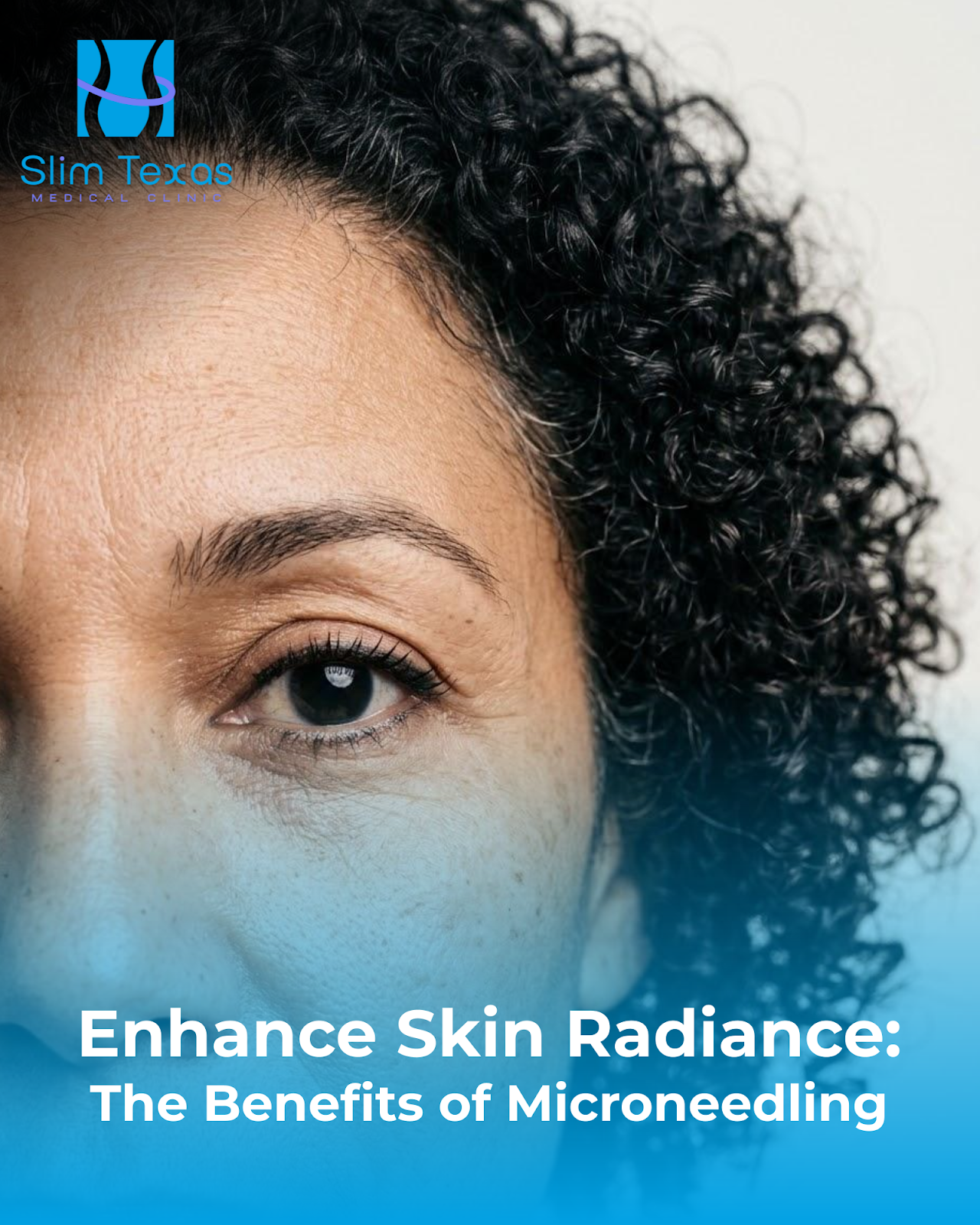 Enhance Skin Radiance: The Benefits of Microneedling