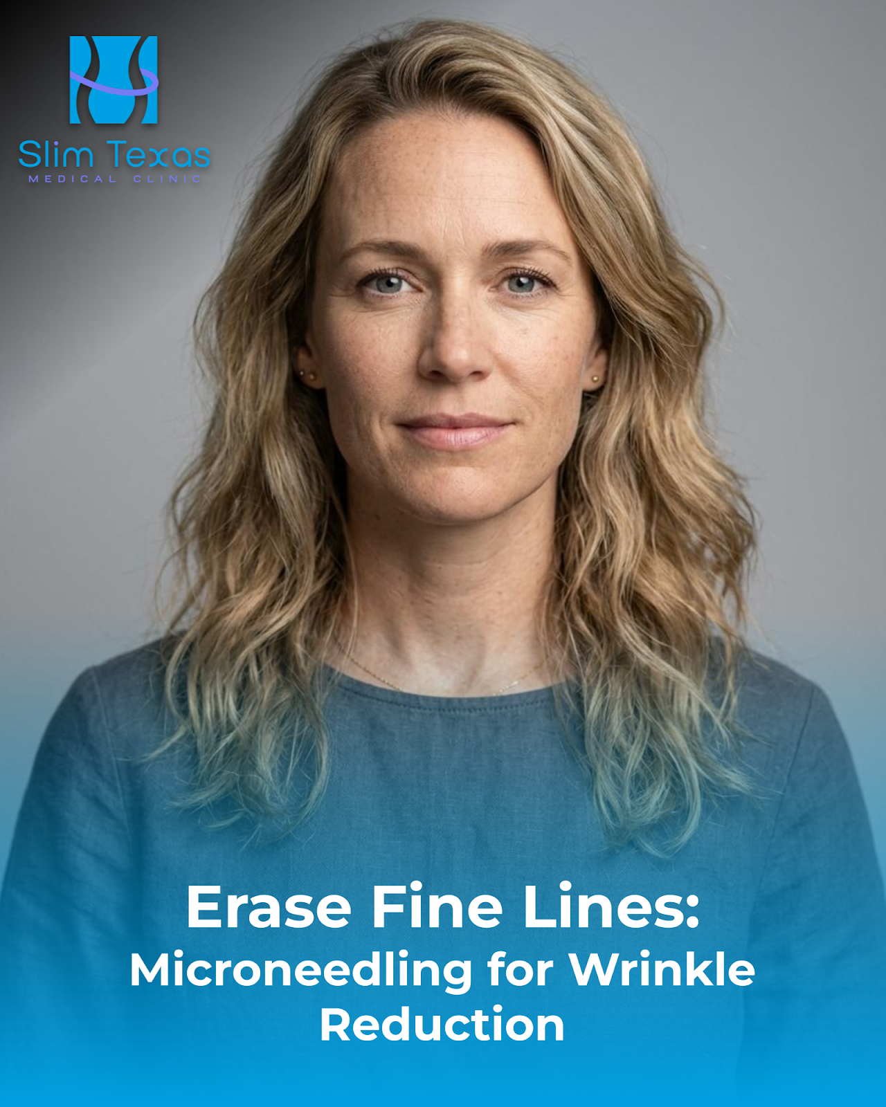 Erase Fine Lines: Microneedling for Wrinkle Reduction