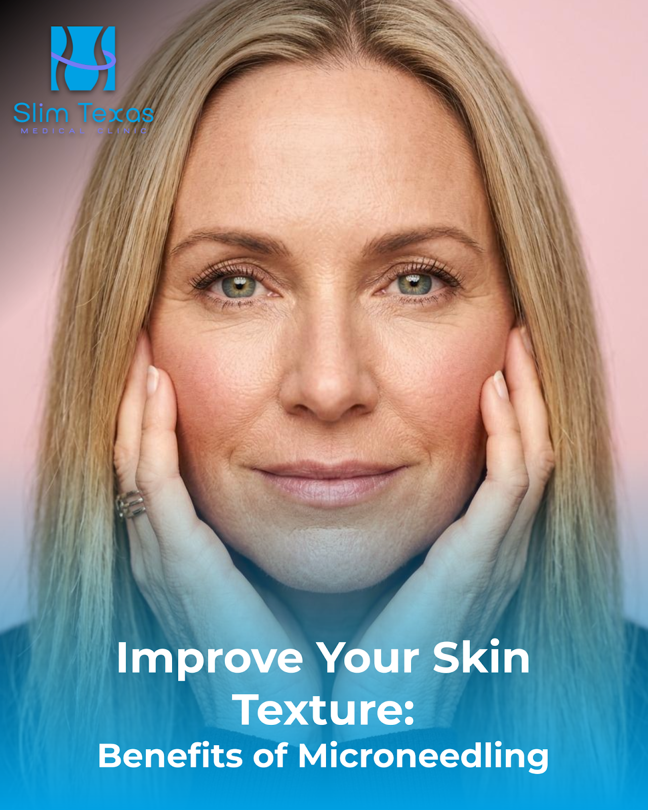 Improve Your Skin Texture: Benefits of Microneedling