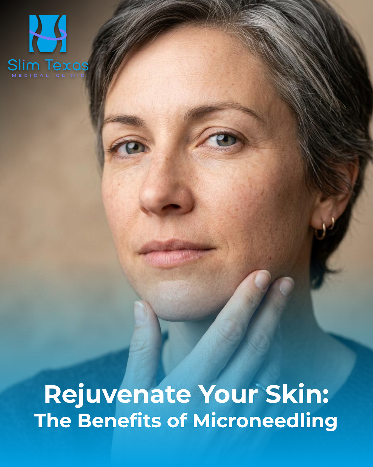 Rejuvenate Your Skin: The Benefits of Microneedling