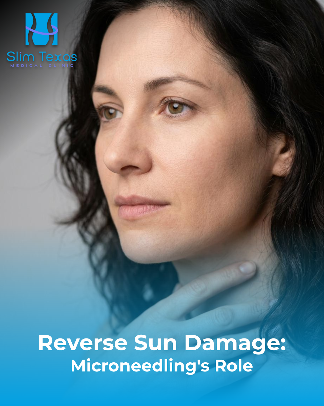 Reverse Sun Damage: Microneedling’s Role
